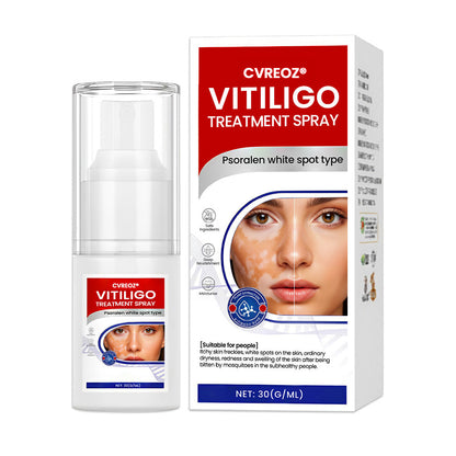Cvreoz® Vitiligo Treatment Spray (Offer)
