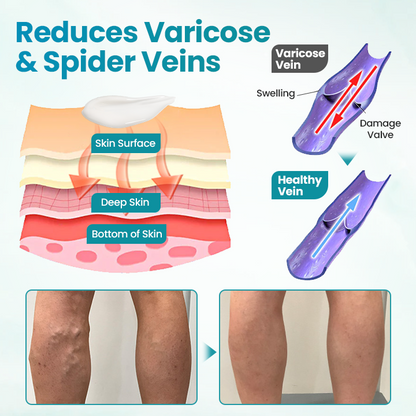 Croaie® VeinAway Relief Cream