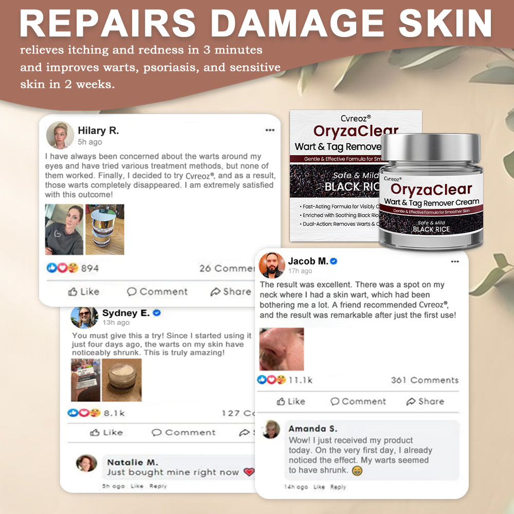 Cvreoz® OryzaClear Wart & Tag Remover Cream 👨‍⚕️ FDA Approved (Gentle & Effective Formula for Smoother Skin)