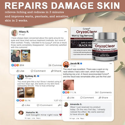 Cvreoz® OryzaClear Wart & Tag Remover Cream 👨‍⚕️ FDA Approved (Gentle & Effective Formula for Smoother Skin)