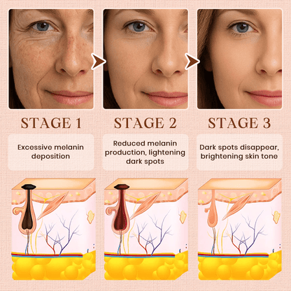 Cvreoz® Purifying Exfoliating Gel for Acanthosis Nigricans, Exfoliation, Dark Spots, Skin Tags, and Eczema ❣️