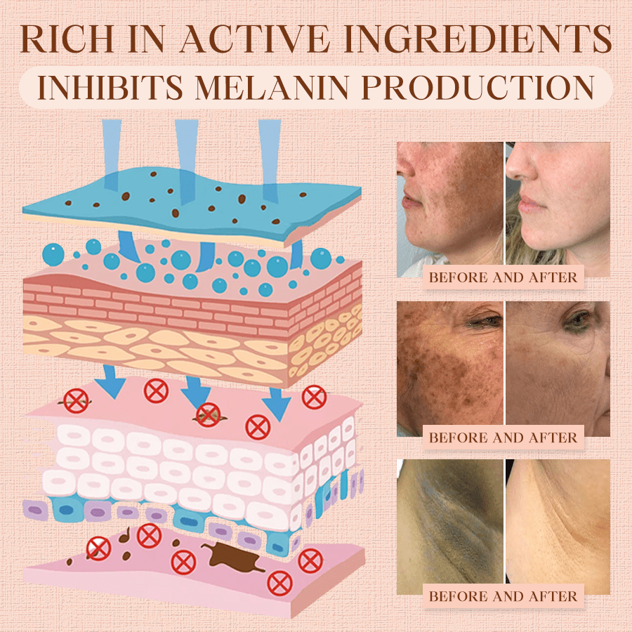 Cvreoz® Purifying Exfoliating Gel for Acanthosis Nigricans, Exfoliation, Dark Spots, Skin Tags, and Eczema ❣️