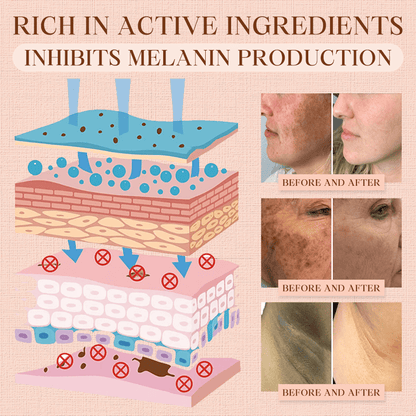 Cvreoz® Purifying Exfoliating Gel for Acanthosis Nigricans, Exfoliation, Dark Spots, Skin Tags, and Eczema ❣️