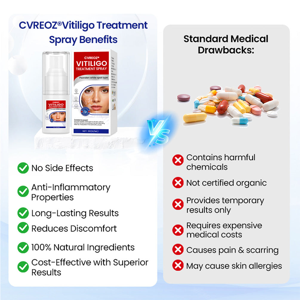 Cvreoz® Vitiligo Treatment Spray (Offer)