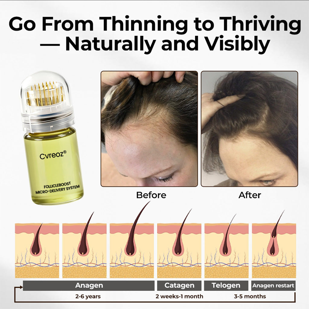 Cvreoz® FollicleBoost Micro-Delivery System Advanced Scalp Renewal Kit