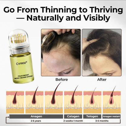 Cvreoz® FollicleBoost Micro-Delivery System Advanced Scalp Renewal Kit