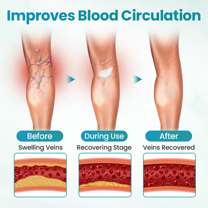 Croaie® VeinAway Relief Cream