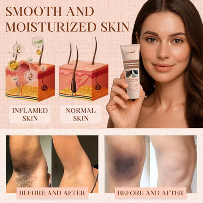Cvreoz® Purifying Exfoliating Gel for Acanthosis Nigricans, Exfoliation, Dark Spots, Skin Tags, and Eczema ❣️
