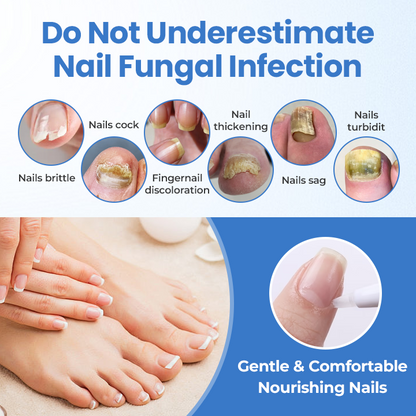 Cvreoz® MycoErase Nail Revive Pen