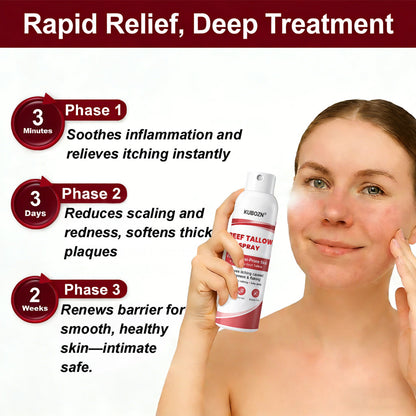KUBOZN® Tallow Spray — The No-Rub Relief for Psoriasis-Prone Skin✨