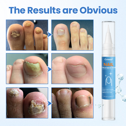 Cvreoz® MycoErase Nail Revive Pen
