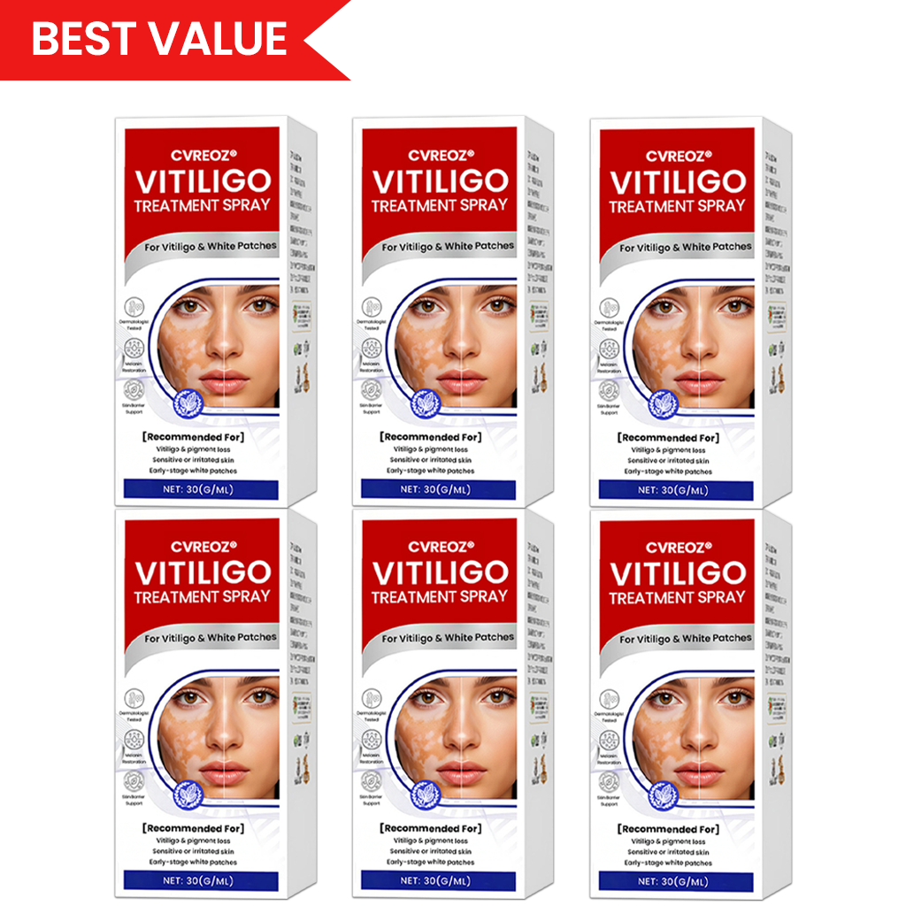 Cvreoz® Vitiligo Treatment Spray (Offer)