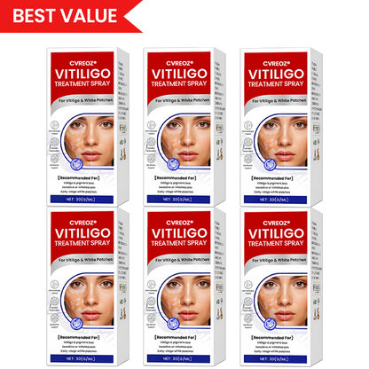 Cvreoz® Vitiligo Treatment Spray (Offer)