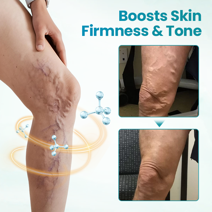 Croaie® VeinAway Relief Cream