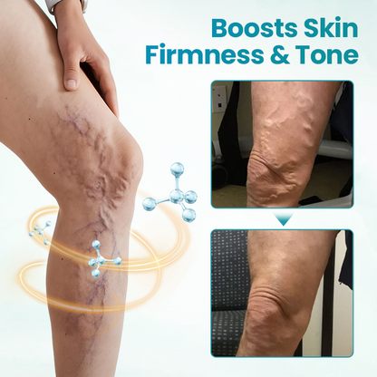 Croaie® VeinAway Relief Cream