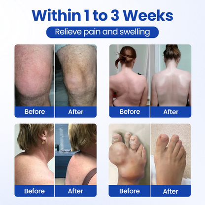 Cvreoz® BPC-157 Joint&Bone Repair Roll-On Gel