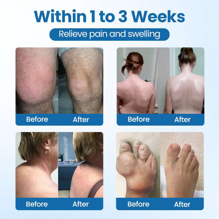 Cvreoz® BPC-157 Joint Repair Cream – Fast Pain Relief & Anti-Inflammatory Power