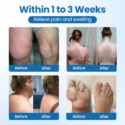 Cvreoz® BPC-157 Joint Repair Cream – Fast Pain Relief & Anti-Inflammatory Power