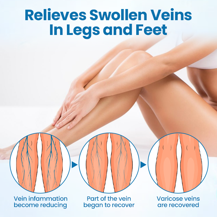 Cvreoz® VeinGuard Herbal Spray