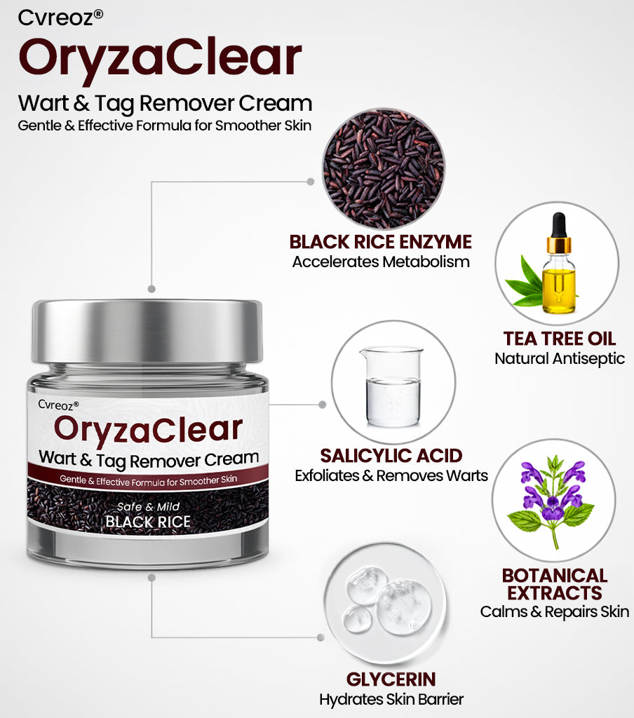 Cvreoz® OryzaClear Wart & Tag Remover Cream 👨‍⚕️ FDA Approved (Gentle & Effective Formula for Smoother Skin)