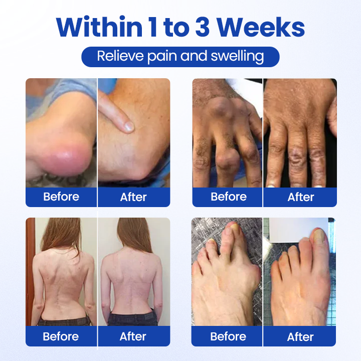 Cvreoz® BPC-157 Joint&Bone Repair Roll-On Gel