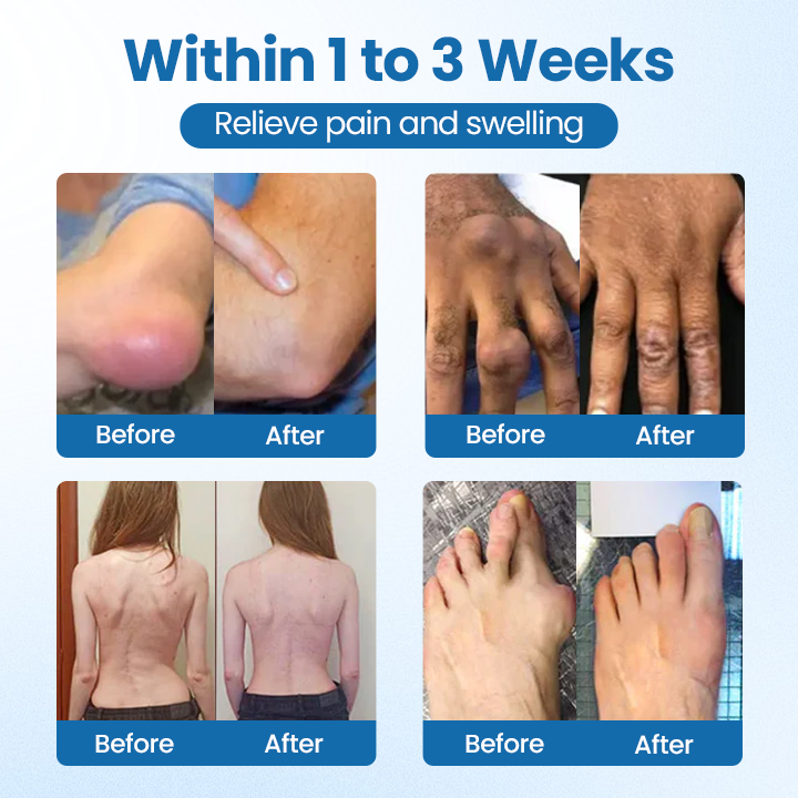 Cvreoz® BPC-157 Joint Repair Cream – Fast Pain Relief & Anti-Inflammatory Power