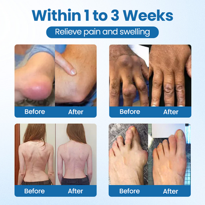 Cvreoz® BPC-157 Joint Repair Cream – Fast Pain Relief & Anti-Inflammatory Power