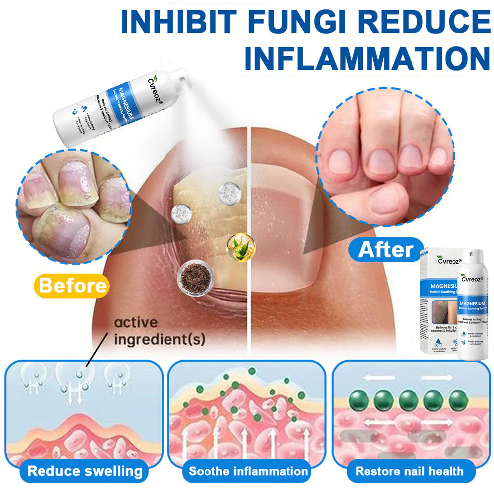 ✅  Official Store: Cvreoz® Magnesium Herbal Psoriasis Spray ⚕️ FDA Certified (for the treatment of psoriasis and eczema, improvement of bacterial infections in the genital area, treatment of acne and warts, eliminates psoriasis and eczema, etc.) (zth)