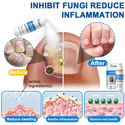 ✅  Official Store: Cvreoz® Magnesium Herbal Psoriasis Spray ⚕️ FDA Certified (for the treatment of psoriasis and eczema, improvement of bacterial infections in the genital area, treatment of acne and warts, eliminates psoriasis and eczema, etc.) (zth)