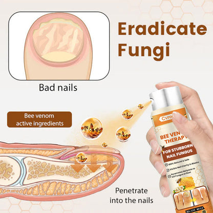 Cvreoz® Bee Venom Nail Fungus Spray