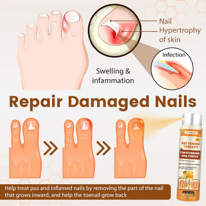 Cvreoz® Bee Venom Nail Fungus Spray