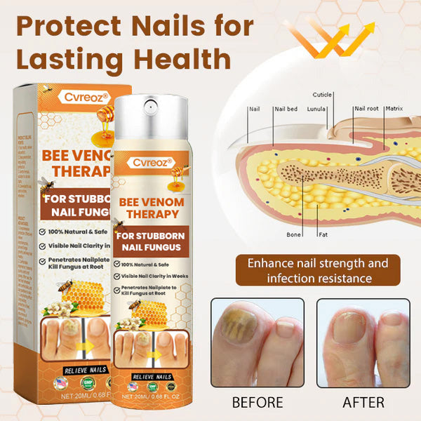 Cvreoz® Bee Venom Nail Fungus Spray