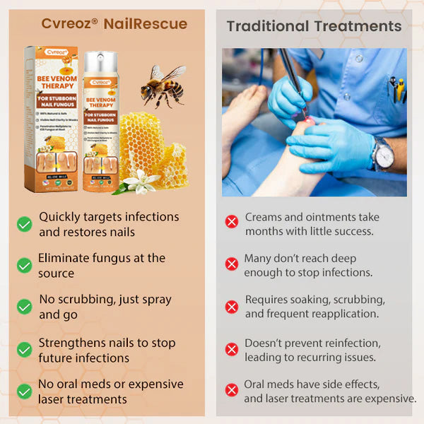 Cvreoz® Bee Venom Nail Fungus Spray