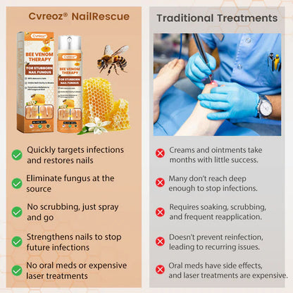 Cvreoz® Bee Venom Nail Fungus Spray